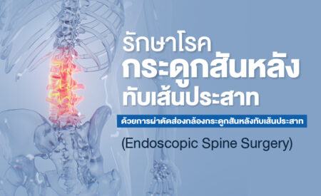 ผ่าตัดส่องกล้องโรคหมอนรองกระดูกสันหลังทับเส้นประสาท