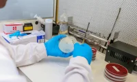 Infectious Diseases